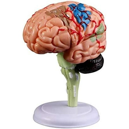 4D Human Brain Model, Disassembled Anatomy Medical Teaching Tool ...