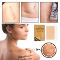 thumbnail image 3 of 2pcs Invisible Concealer, Skin Concealer Tattoo Scar Cover Invisible Waterproof Skin Tone Cover, 3 of 5
