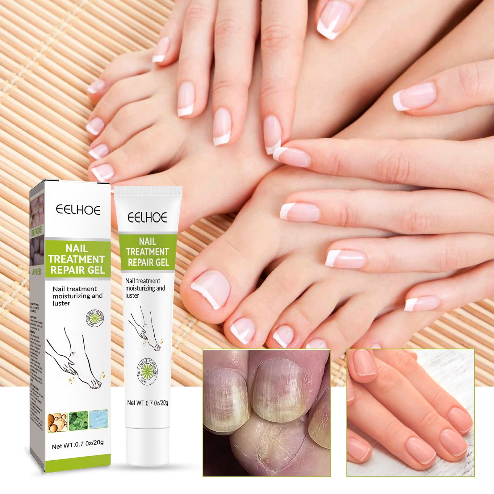 Nails After Gel Removal