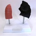 thumbnail image 3 of Smoker's Lung Model Healthy Lung Model Lung Anatomy Model With Pathological Respiratory System Disease Lungs, 3 of 5