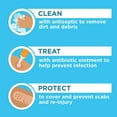 thumbnail image 4 of Band Aid Pansement de Soins des Plaies en Gaze Flexible Roulée de Marque First Aid, 4 Po x 2,1 Verges, 5 Unités, 4 of 11