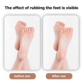 thumbnail image 4 of Foot File Callus Remover for Feet Wet and Dry Foot Scrubber Dead Skin Remover Pedicure Tool, 4 of 5