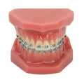 thumbnail image 2 of Modelo de dientes con soporte de metal BuyWeekMX 28 piezas Modelo de ortodoncia didáctico, 2 of 9