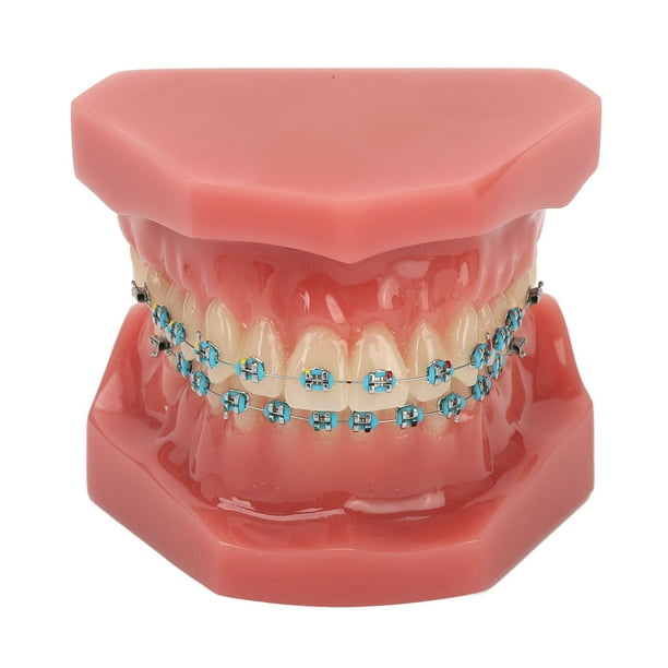 Modelo de ortodoncia dental de 28 piezas, resina dental, modelo de enseñanza dental con brackets metálicos.
