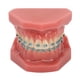 thumbnail image 1 of Modelo de ortodoncia dental de 28 piezas, resina dental, modelo de enseñanza dental con brackets metálicos., 1 of 14