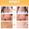 thumbnail image 3 of Spray 3Pcs Body Scar Removal Spray Stretch Mark Diminishing Spray Skin Smoothing Moisturizing Spray 20g, 3 of 8