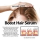 thumbnail image 2 of Hair Growth Serum Spray, Anti Shedding Hair Spray, Natural Hair Essence Spray, 2 of 5