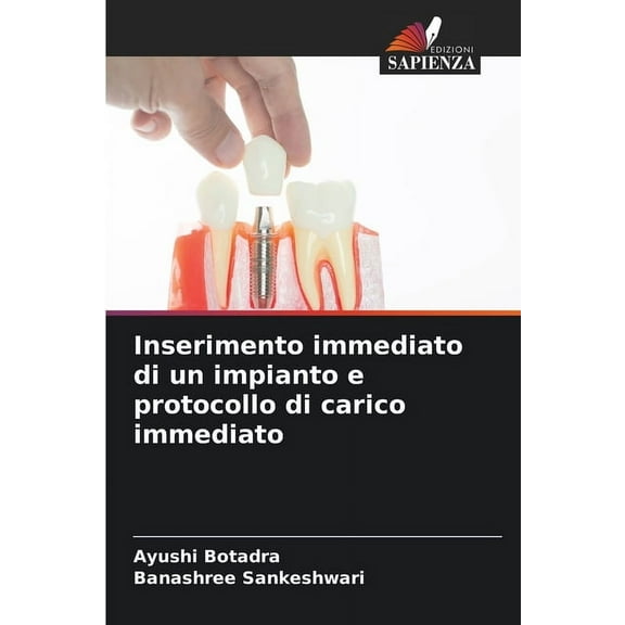 Inserimento immediato di un impianto e protocollo di carico immediato, (Paperback)