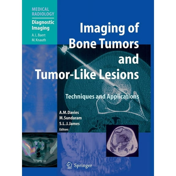 Imaging of Bone Tumors and Tumor-Like Lesions: Techniques and Applications, (Paperback)