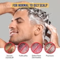 thumbnail image 2 of Champú antifúngico RootStim para foliculitis 240 ml, 2 of 9