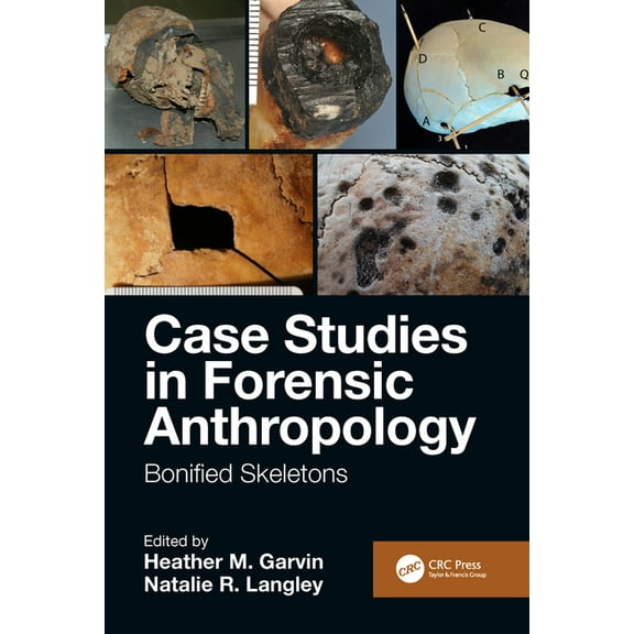 Case Studies in Forensic Anthropology: Bonified Skeletons (Hardcover)