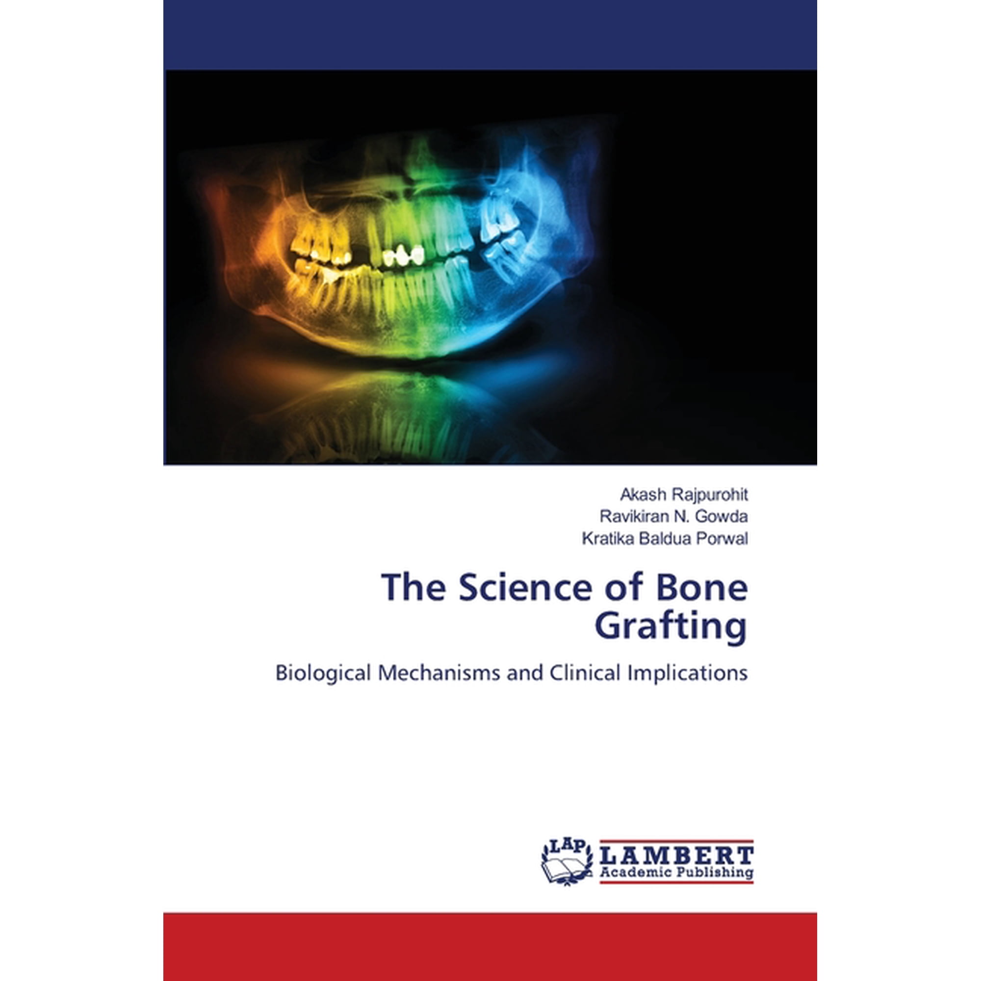 The Science of Bone Grafting (Paperback)