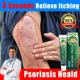 thumbnail image 4 of Crema antihongos para Psoriasis, tratamiento de infección por hongos para la piel, pomada médica para picazón, 2024, 4 of 4