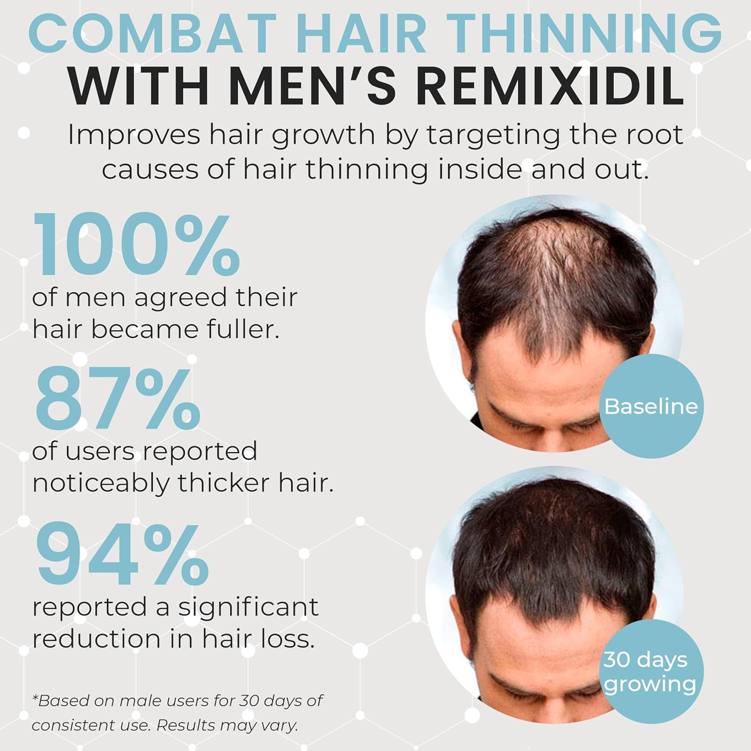 Hair Growth Vitamins Hair Regrowth For Men  Supports Beard And Scalp Strength  Helps Reduce Thinning And Breakage