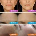 thumbnail image 4 of Set de cuidado de la piel GLEOW, sérum de retinol, vitamina C, 180 ml, 6 unidades, 4 of 6
