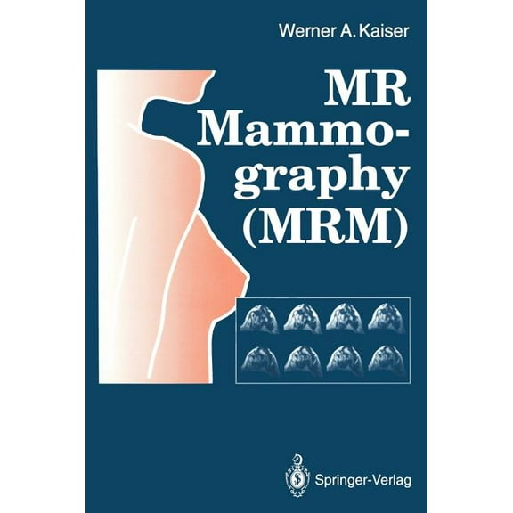 MR Mammography (Mrm), (Paperback)