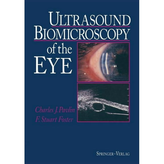 Ultrasound Biomicroscopy of the Eye, (Paperback)