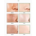 thumbnail image 4 of Bastón de Mascarilla Facial MISEDI con Extracto de Té Verde para Limpieza Profunda de Poros 2 unidades, 4 of 6