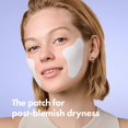thumbnail image 2 of Cream Patch HERO COSMETICS Rescue Patch hidratante, 6 unidades, 2 of 9