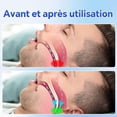 thumbnail image 5 of Anti-Ronflement, Lot de 2, Correcteur Anti-Ronflement Réutilisable, Correcteur de Sommeil Silencieux, Bleu., 5 of 5