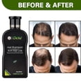 thumbnail image 4 of Champú para el crecimiento del cabello fino y la caída del cabello, para engrosar el cabello y para el cuero cabelludo, 198 ml, 4 of 4