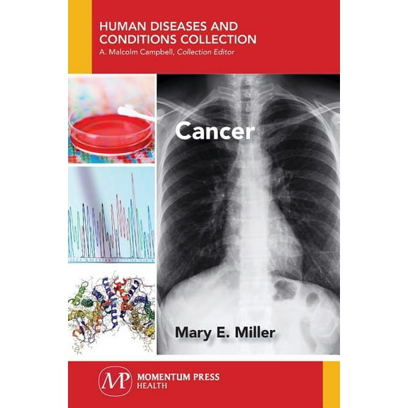 Cancer, (Paperback)