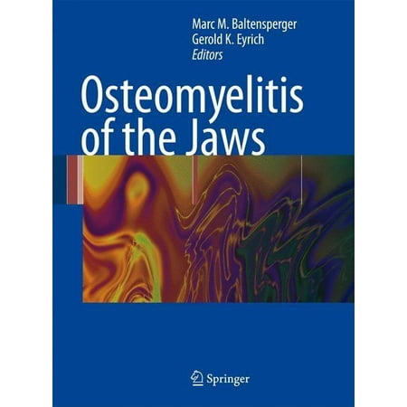 UPC: 9783540287643 | Osteomyelitis of the Jaws (Hardcover)