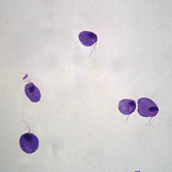Trichomonas Vaginalis Slide, Smear