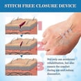 thumbnail image 3 of 5pcs Wound Closure Strip, Stitch Free Closure Device, Zip and Stitch Suture-Free, Adhesive Stitch Close Wound Device, Flexible Fabric Adhesive Bandage, 3 of 5