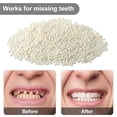 thumbnail image 2 of Kit de reparación temporal de Gel sólido de dientes de 50 g, cuentas de ajuste térmico moldeable, adhesivo para dientes falsos para Halloween, miedo oso de fresa Hogar, 2 of 5