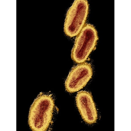 Molluscum Contagiosum Virus Tem X200,000 Print Wall Art By Veronkia (Best Treatment For Molluscum Contagiosum Genital)