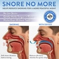thumbnail image 3 of Good Morning Snore Solution Taille Originale, 3 of 9