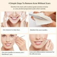 thumbnail image 3 of BESTOPE Blackhead Remover Pimple Comedone Extractor Tool Best Acne Removal Kit - Treatment for Blemish, Whitehead Popping, Zit Removing for Risk Free Nose Face Skin with Metal Case, 3 of 7