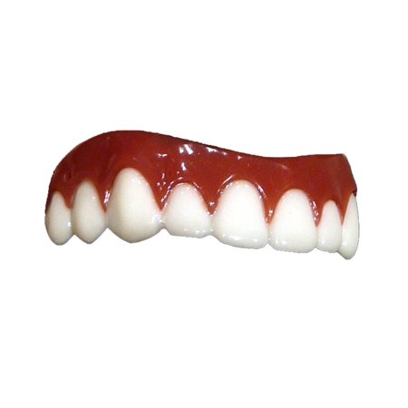 Hollywood Game Show Smile Upper Teeth Veneer Dental Distortions