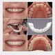 thumbnail image 4 of Soft Silicone Denture Teeth Veneers Temporary Teeth, 4 of 5