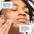 thumbnail image 4 of Bubble Skincare Acne Kit, All Skin Types, 3 Items Included, 4 of 11