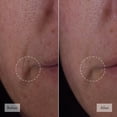 thumbnail image 4 of Sérum facial Philosophy Dose of Wisdom Bouncy Skin Rebuilding, 4 of 7