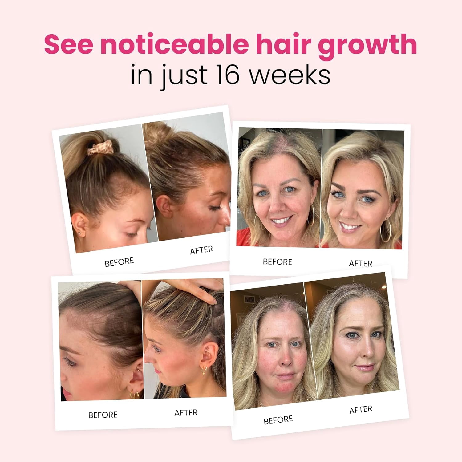 Trybello Hair Growth Shampoo | Natural Hair Thickening & Scalp Detox | Sulfate Free, Vegan, Anti-Hair Fall Formula | Caffeine, Aloe Vera, Turmeric, and Urucum Extract | For Any Hair Type