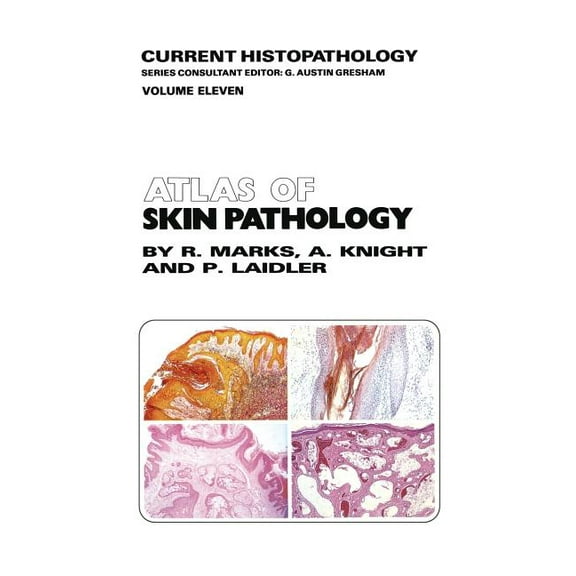 Current Histopathology Atlas of Skin Pathology, Book 11, (Paperback)