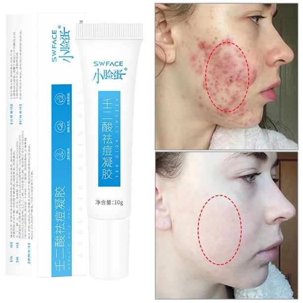 Efero-crema blanqueadora de caracol para cara, crema antiarrugas, tratamiento de manchas y acné, crema facial reparadora de caracol, crema hidratante reafirmante"green ef" Fivean LED
