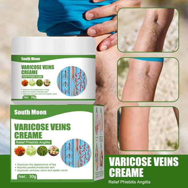 Varicose Veins Cream Relief Phlebitis Angiitis Remedy Pain Relief Cream for Spider Veins Edema