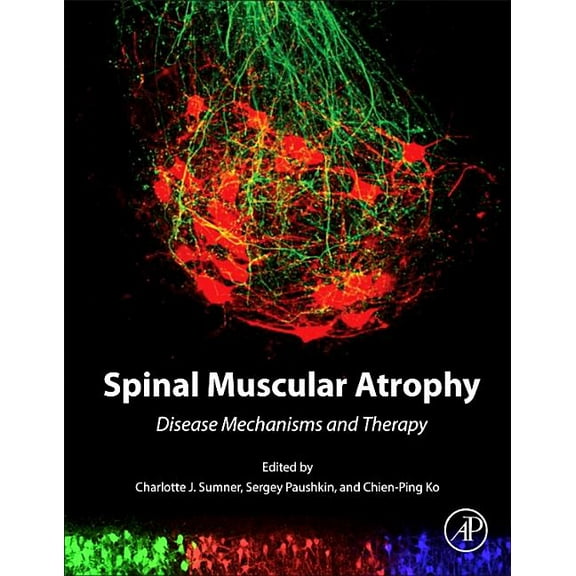 Spinal Muscular Atrophy: Disease Mechanisms and Therapy, (Hardcover)