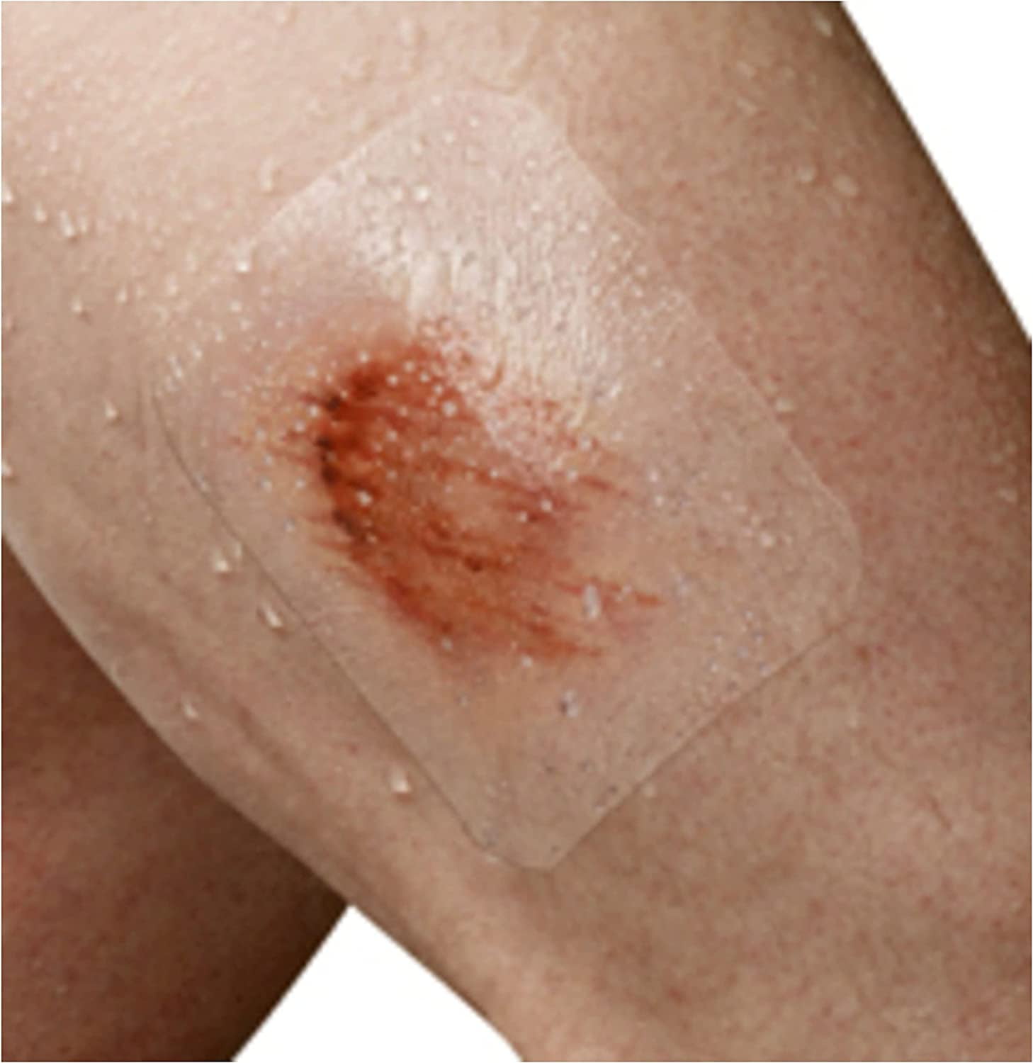 Nexcare Tegaderm Waterproof Transparent Dressing 10 ct (Pack of 2)