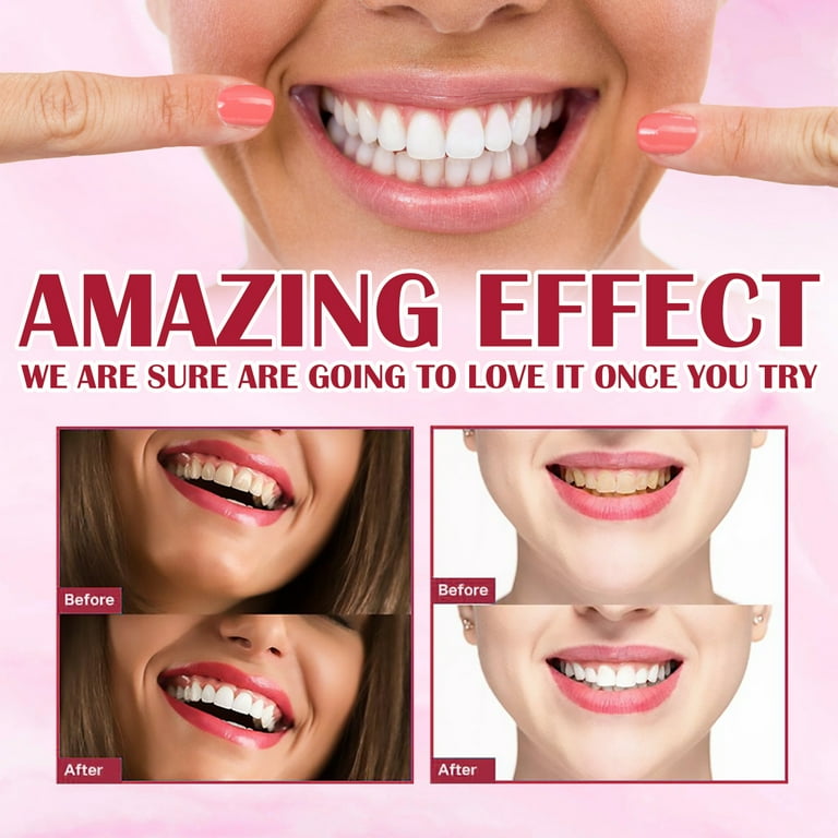 Sp-4 Toothpaste, SP-4 Brightening & Stain Removing Toothpaste