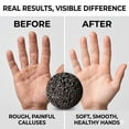thumbnail image 5 of 2026 New Callus_Ball For Hand, Moon_Round Grip Ball Callus Rock, Hand Grip Strength Trainer For Rock-Solid Hands Rock Climbing Grip Trainer, Anti-Sweat Grip Strengthener, 5 of 19