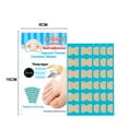 thumbnail image 5 of Kripyery 36Pcs/48Pcs/60Pcs/72Pcs/120Pcs Toenail Patches Self-Adhesive Three-Layer Fabric New Ingrown Toenail Corrector Sticker for Unisex, 5 of 7