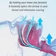 thumbnail image 2 of Silicone Quietnights Tongue Retainer, 2024 New Snore Destroy Tongue Retainer, New 26-27s, 2 of 4