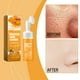 thumbnail image 4 of Limpiador facial, limpiador facial Limpiador de cúrcuma Limpiador hidratante facial Limpiador Reduce los poros Refrescante Aclara las manchas Uniformiza el tono Reduce las imperfecciones Aclara la pie, 4 of 5