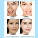 thumbnail image 4 of 30g Crema Anti-Envejecimiento Blanqueador Pecas Crema para aclarar la piel (Ácido hialurónico) Likrtyny Cuidado Belleza, 4 of 6