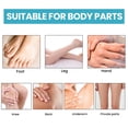 thumbnail image 3 of Exfoliating Body Pads for Dark Knees & Elbows, Kojic Acid & Witch Hazel, Brightening & Smoothing, 30 Pads, 3 of 6